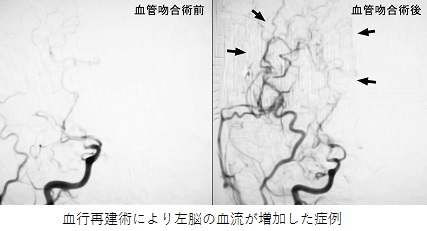 脳外写真3